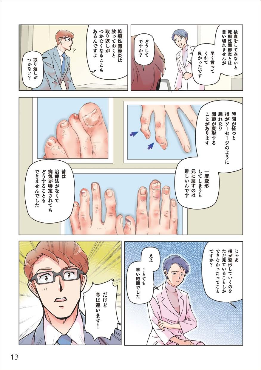 検査をしてみないと乾癬性関節炎とは言い切れませんが、早く言ってくれてよかったです。乾癬性関節炎はほっておくと取返しがつかなくなることがあるんですよ。時間が経つと指がソーセージのように腫れたり、関節が変形することがあります。一度変形してしまうと元に戻すのは難しいんです。昔は治療法がなくて、病気が特定されてもどうすることもできませんでした。だけど今は違います！