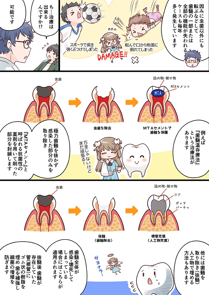 因みに虫歯以外にも転ぶなどして、歯髄の一部または全部の機能が失われるケースも毎年多く発生しています。例えば「歯髄温存療法」という治療法があります。極力歯髄を抜かず、感染した部分のみを取り除き、「MTAセメント」と呼ばれる抗菌性の薬剤を用いて削った部分を封鎖します。