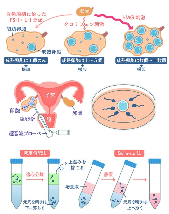 タッチ18