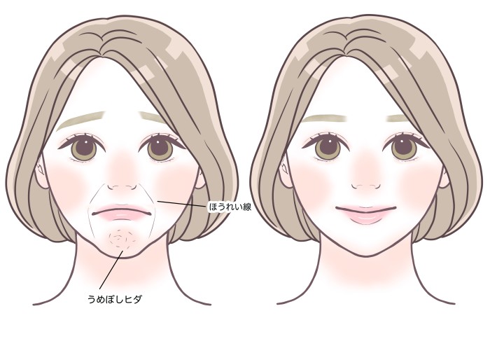 タッチ8